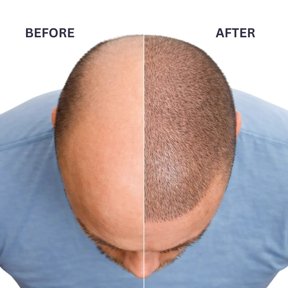 Before After