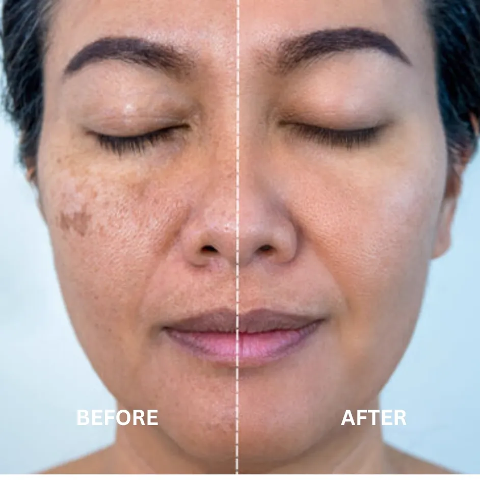 Before After
