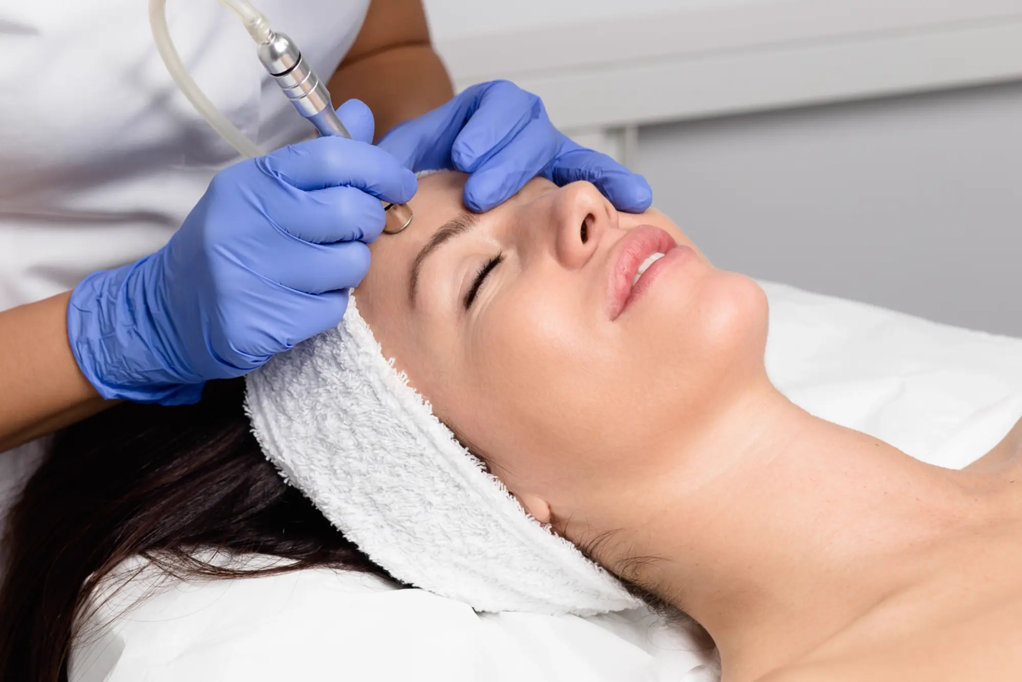Microdermabrasion