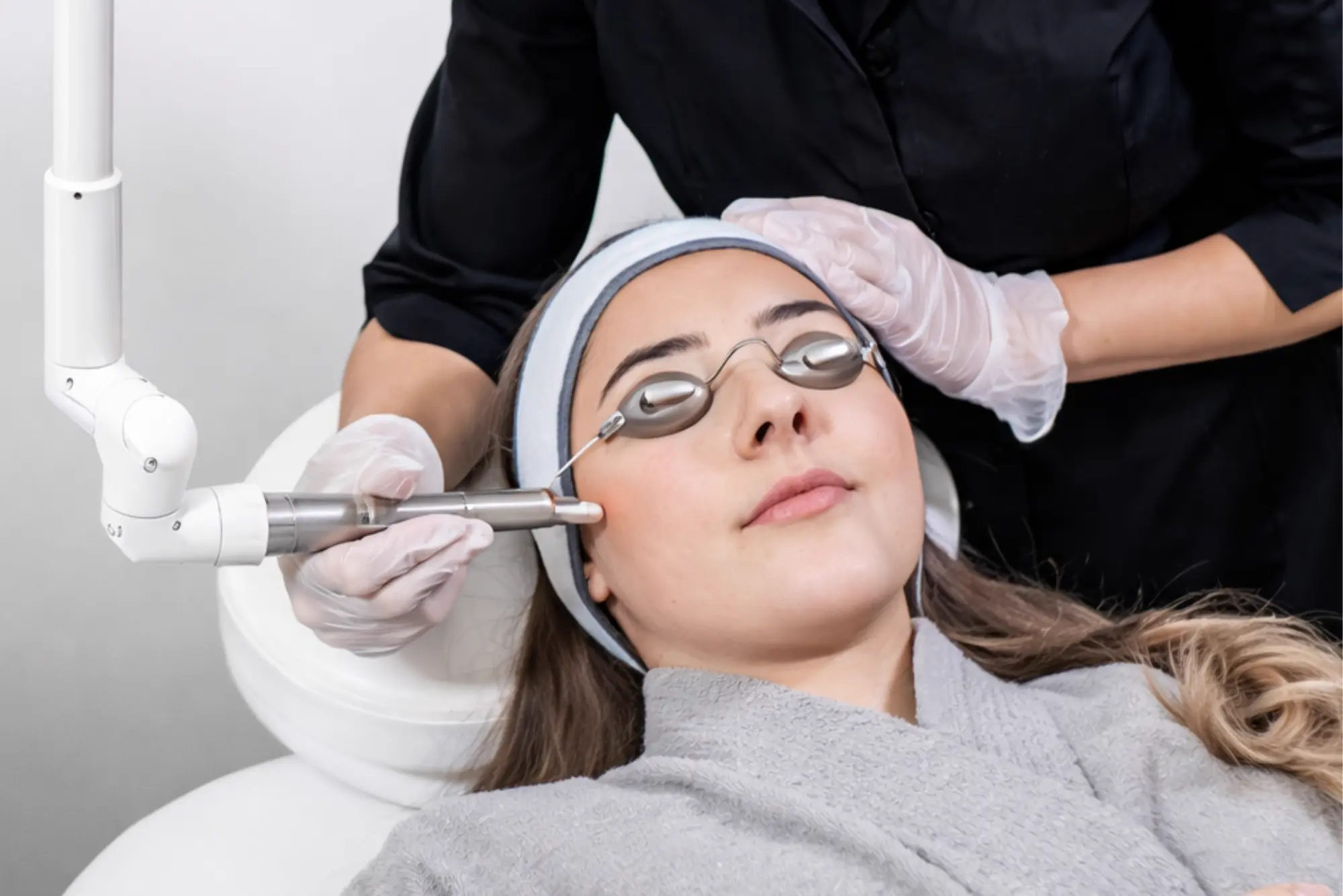 Q-Switch ND YAG Laser
